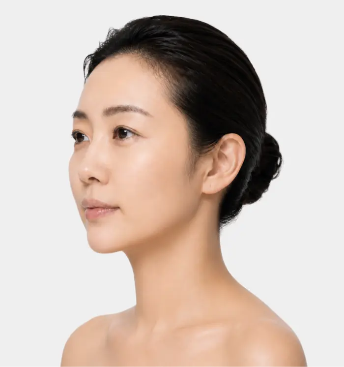 面部抗衰