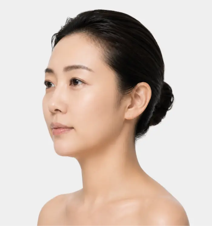 面部抗衰